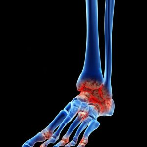 3 Dedos de los pies y tobillos